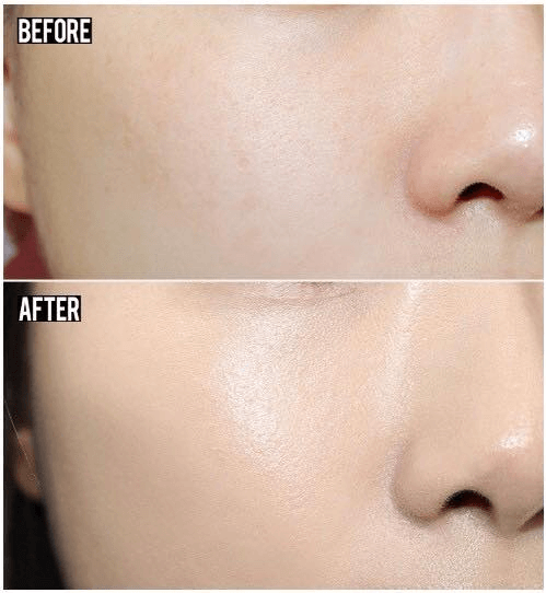 Da mặt mình trước và sau khi sử dụng sản phẩm Oribe được 1 tháng