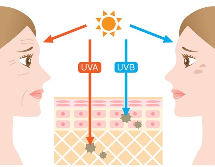 Những tác hại của tia UV đối với làn da